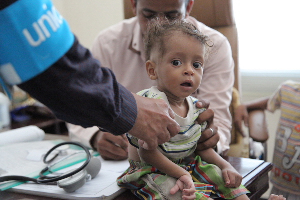 예멘 사다 지역 한 병원에서 심각한 급성 영양실조로 진료 받고 있는 어린이의 모습. 영양실조 위기를 겪고 있는 5세 미만 영유아 어린이는 약 46만 명에 이른다. (사진/뉴시스) 